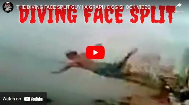 (Leaked) Face Split Diving Accident Video Viral On Twitter and Reddit